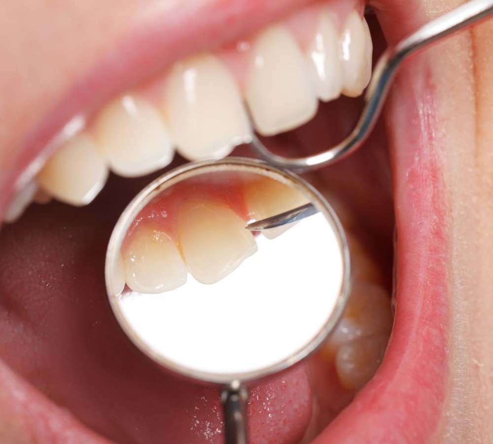 Comprehensive Oral Evaluation (Dental Exam)